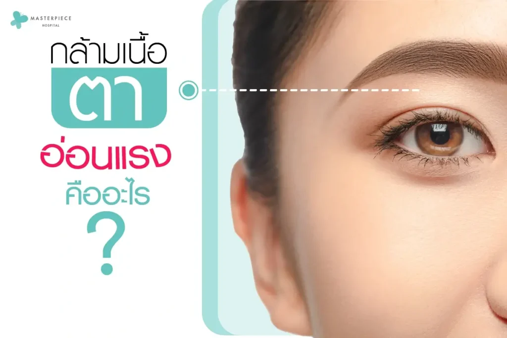 กล้ามเนื้อตาอ่อนแรงคืออะไร-01