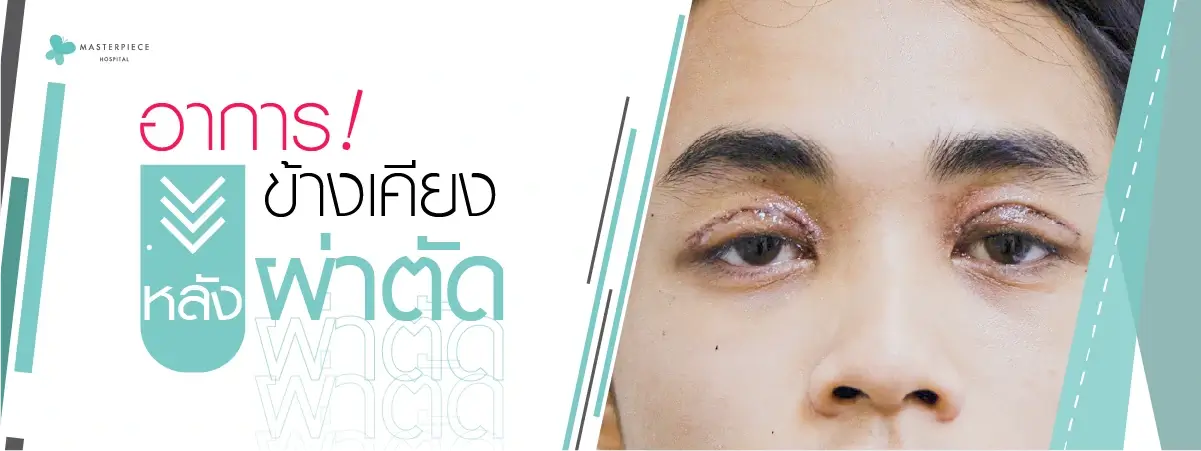 อาการข้างเคียงหลังผ่าตัด