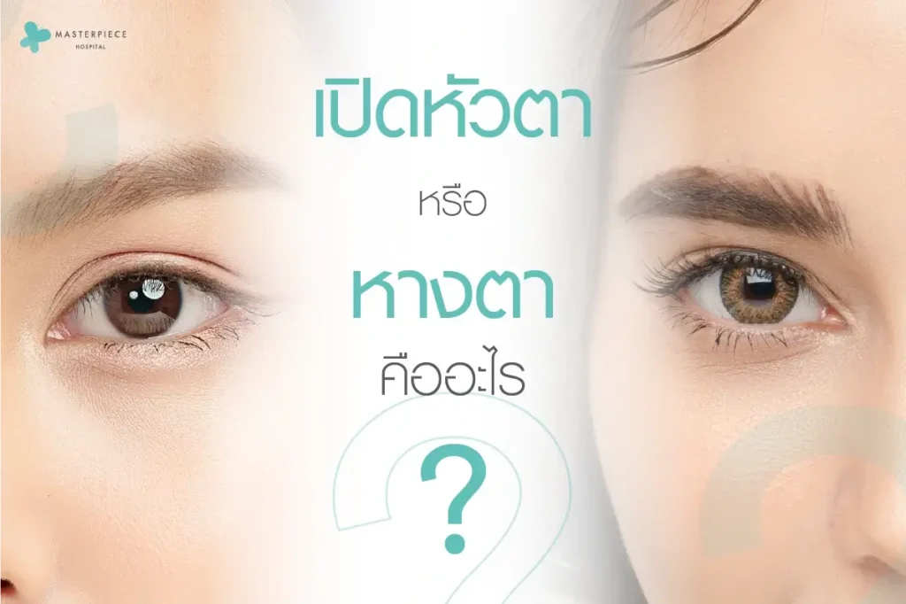 ศัลยกรรมเปิดหัวตา หางตาคืออะไร