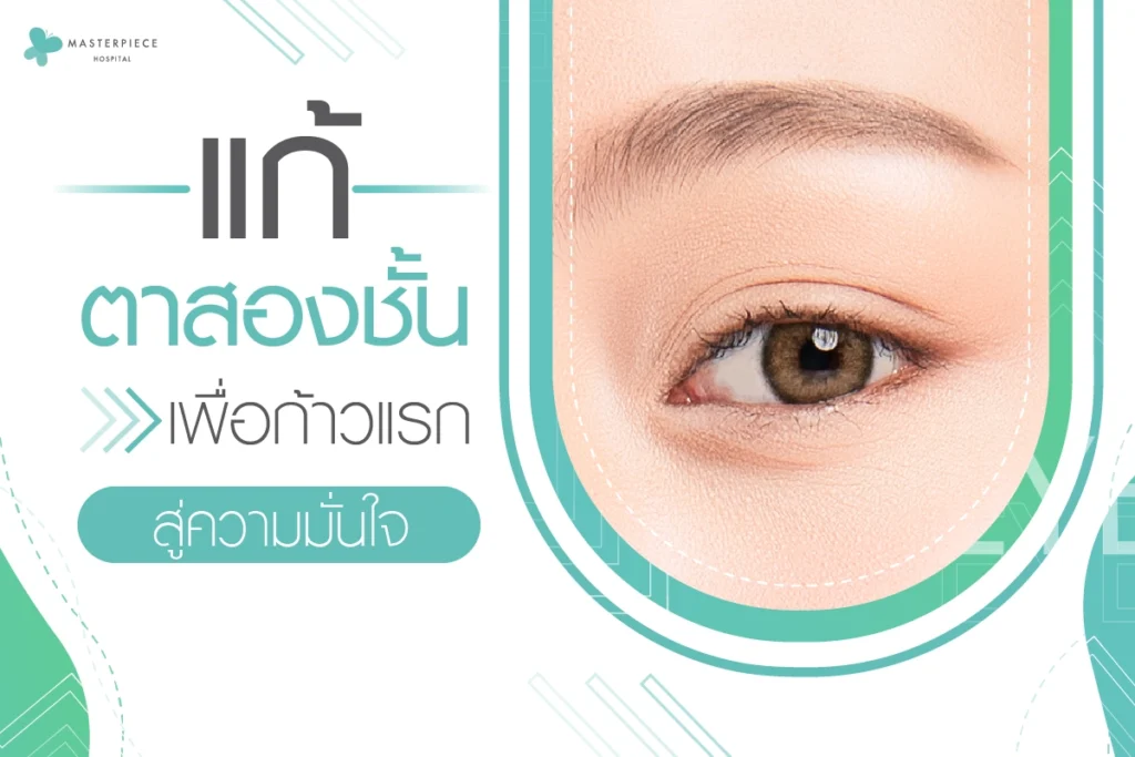 แก้ตาสองชั้นเพื่อก้าวแรกสู่ความมั่นใจ