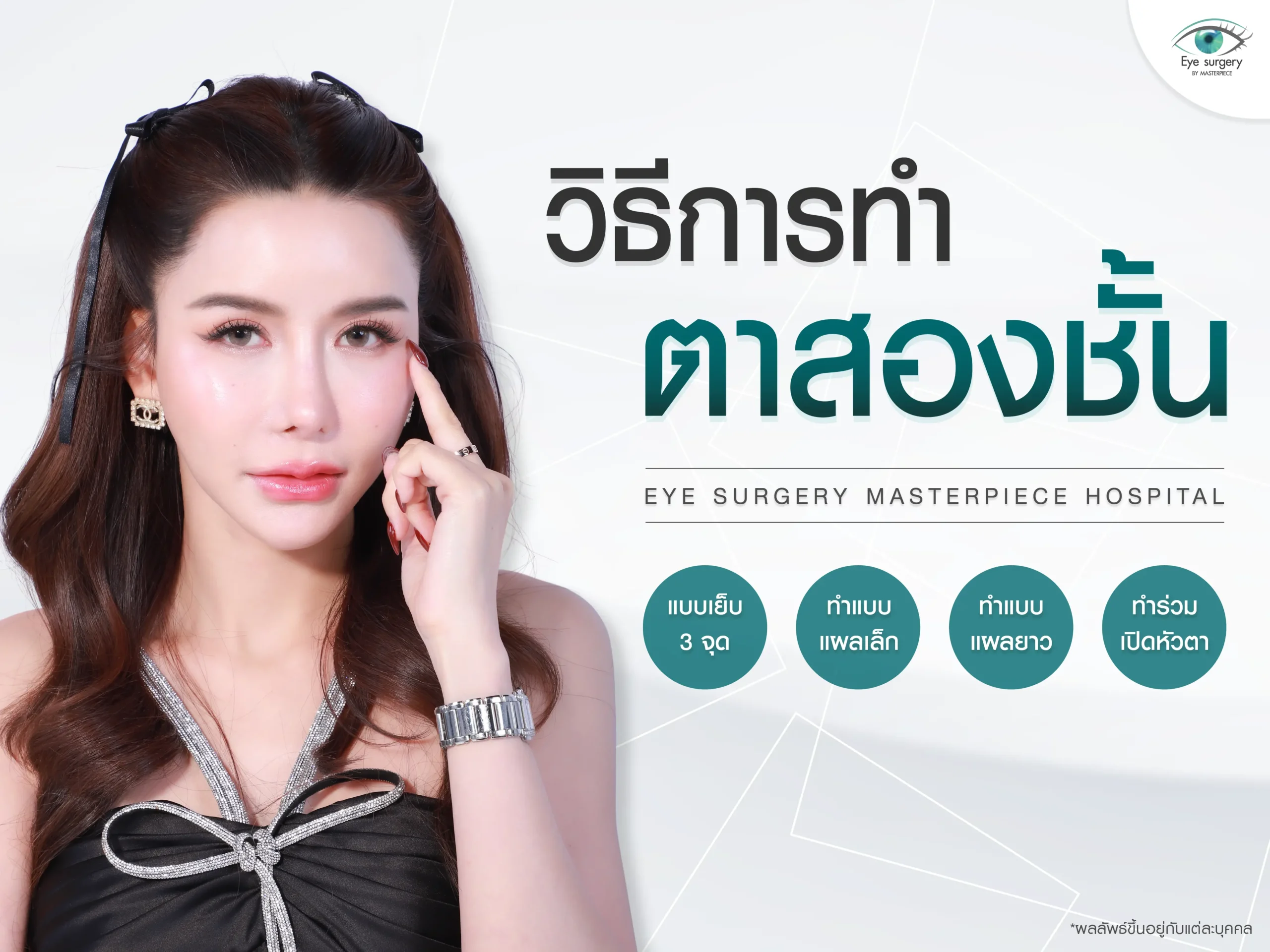 วิธีการทำตาสองชั้น