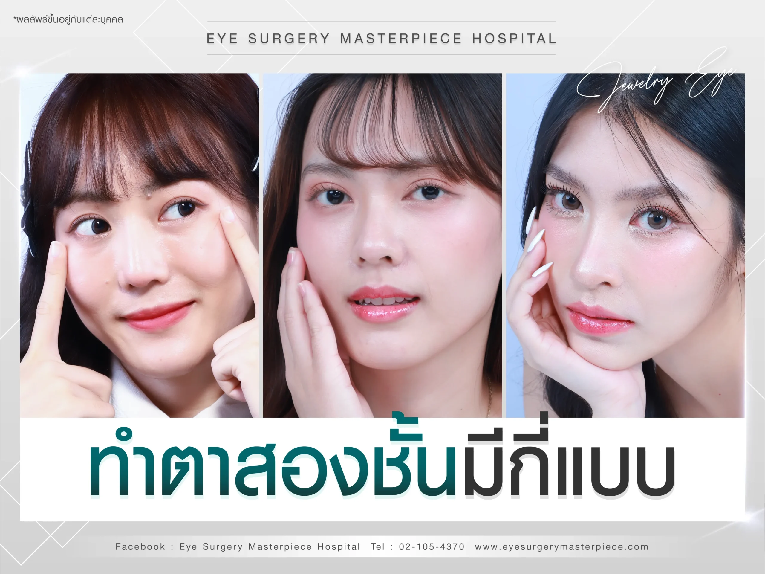 ทำตาสองชั้นมีกี่แบบ