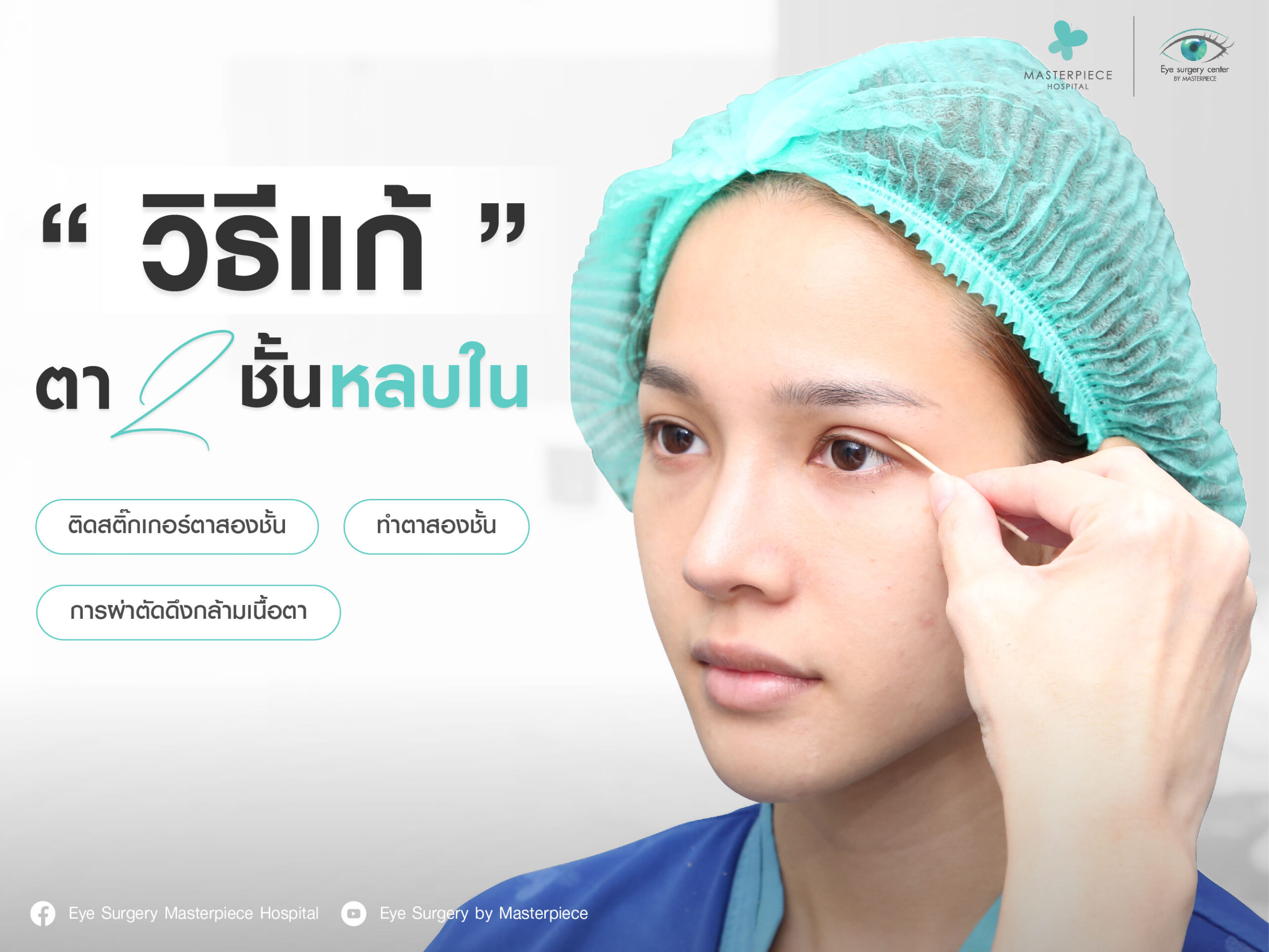 วิธีแก้ตาสองชั้นหลบใน