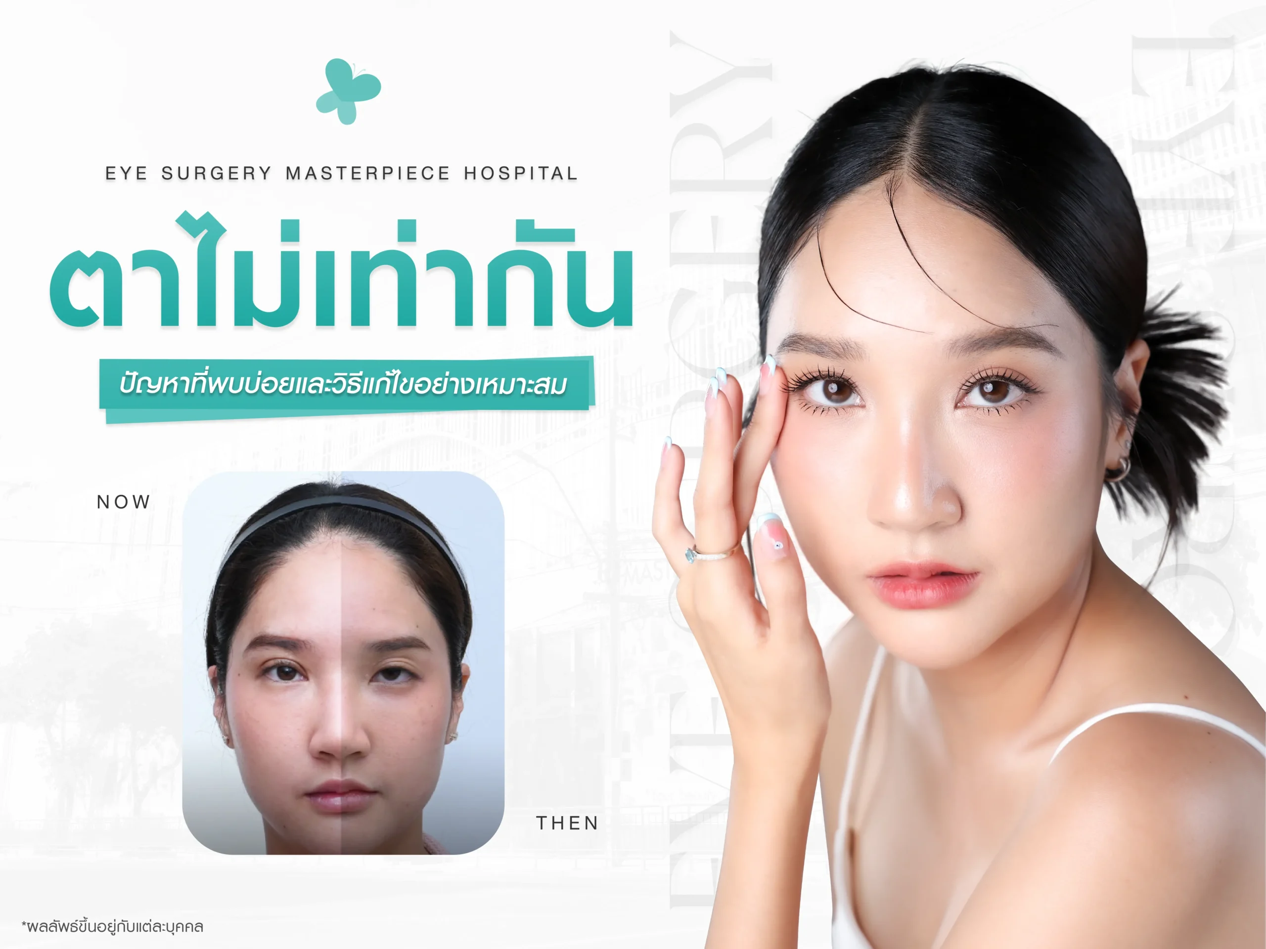 ตาไม่เท่ากัน ปัญหาที่พบได้บ่อยและวิธีแก้ไขอย่างเหมาะสม