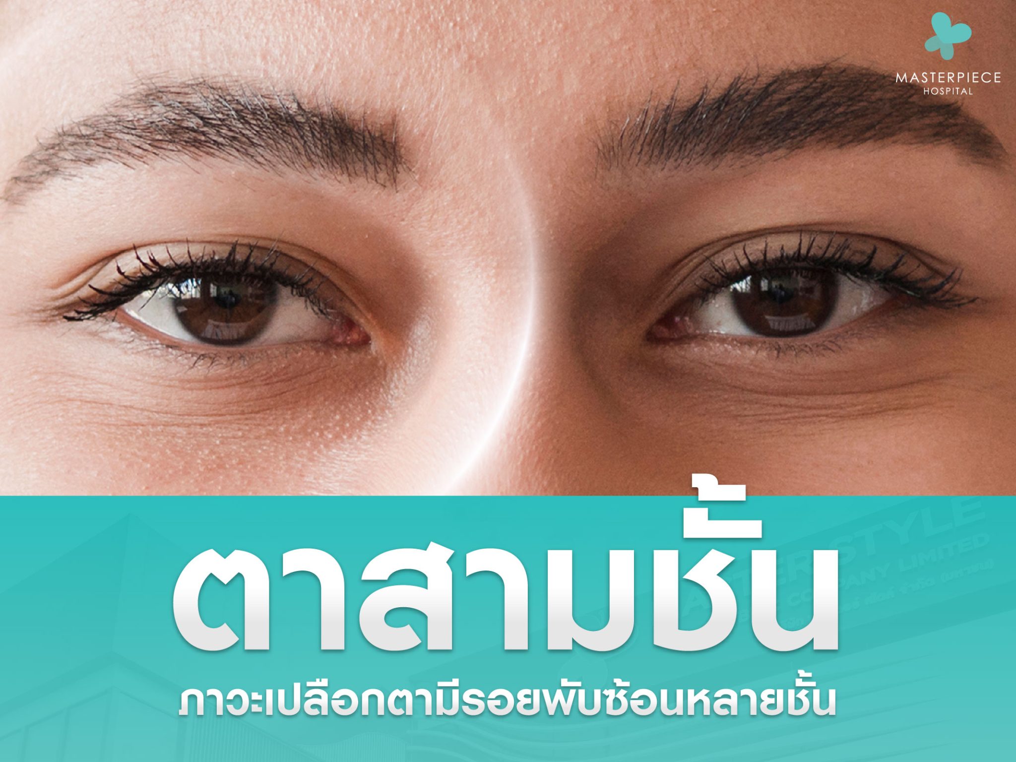 ตาสามชั้น ภาวะที่เปลือกตามีรอยพับซ้อนหลายชั้น เกิดจากอะไรได้บ้าง