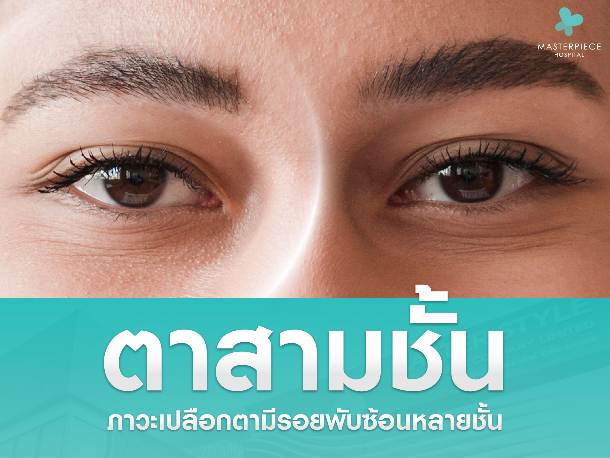ตาสามชั้น ภาวะที่เปลือกตามีรอยพับซ้อนหลายชั้น เกิดจากอะไรได้บ้าง