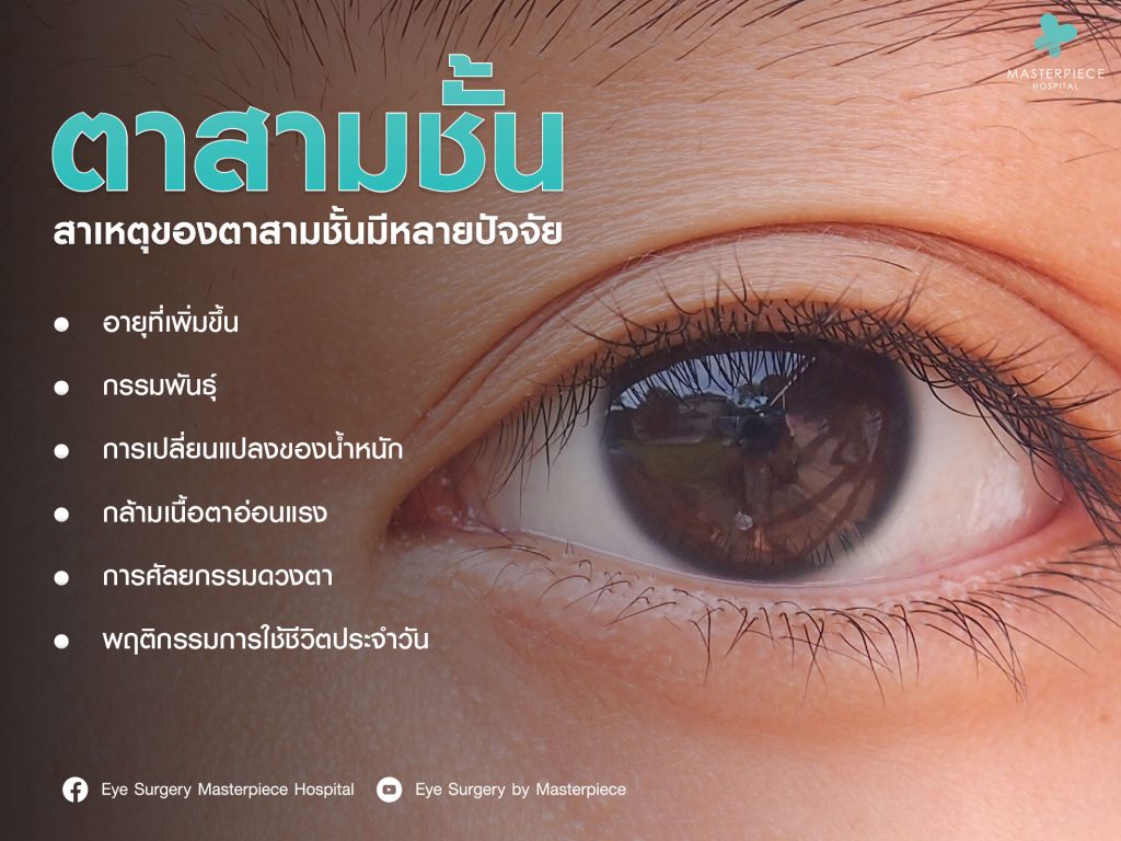 ตาสามชั้นเกิดจากอะไร