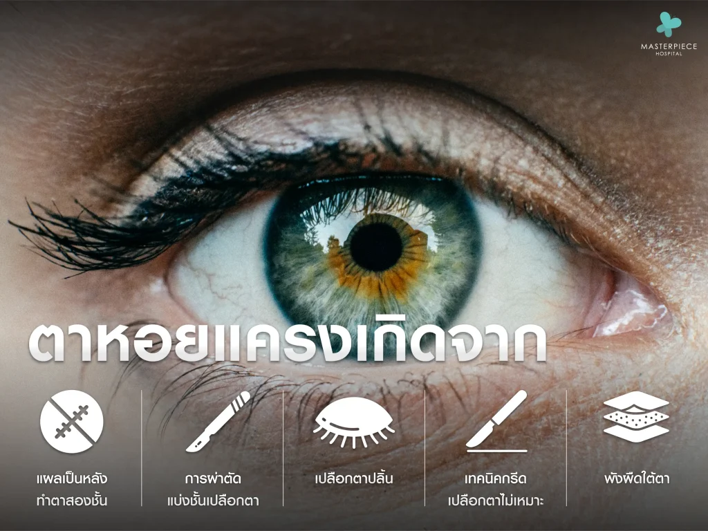 ตาหอยแครงเกิดจากอะไรได้บ้าง